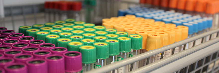 Et nærbilde av en haug med fargede knapper