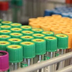 Et nærbilde av en haug med fargede knapper