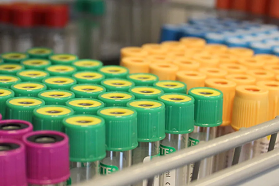 prøverørsglas med ulike fargar på lokka